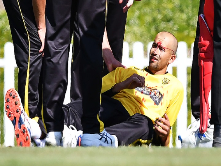 ashton agar suffers gruesome nose injury after spilling his brothers catch in marsh odi cup Ashton Agar Suffers Gruesome Nose Injury After Spilling His Brother's Catch | Watch