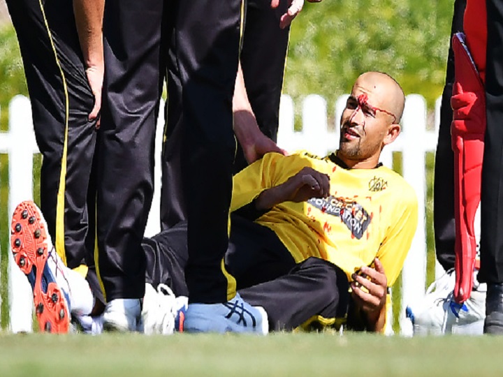 Ashton Agar Suffers Gruesome Nose Injury After Spilling His Brother's Catch | Watch